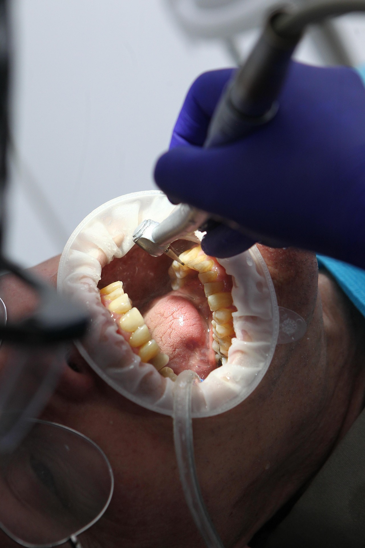 Dental examination detail, illustrative dental-care visual